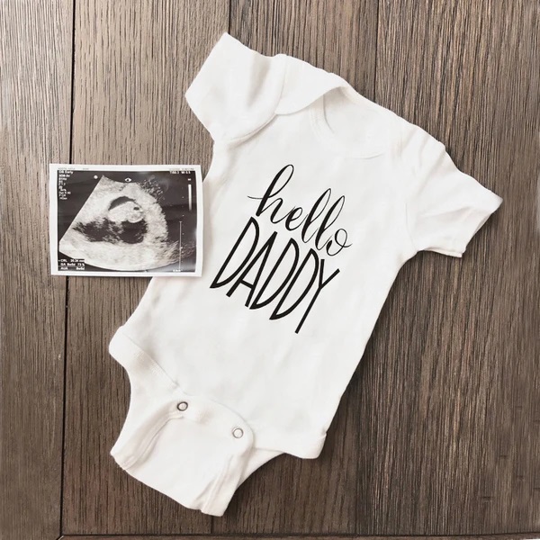 Baby Clothing Brands - Verão bebê recém-nascido da menina do